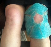 7 Ways to Prevent Cycling Knee Pain