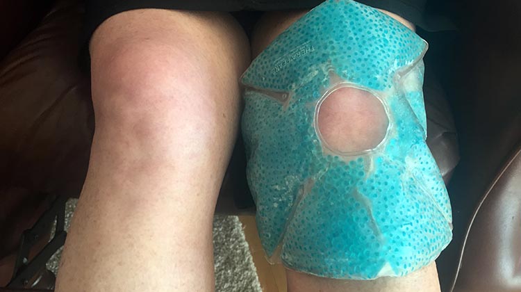 Prevent cycling knee pain with proactive icing using a Therapearl knee wrap pad