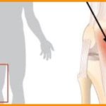 ways to prevent cycling knee pain